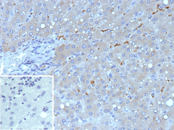 HNF1B Antibody