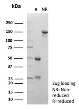 HNF1B Antibody