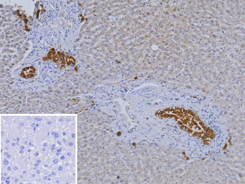 HNF1B Antibody