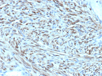 STAT6 Antibody