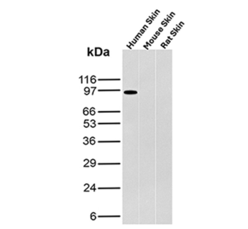 STAT6 Antibody