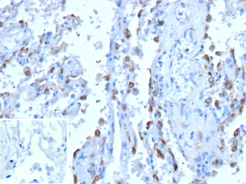 PRPH Antibody