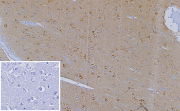 CXCR5 Antibody