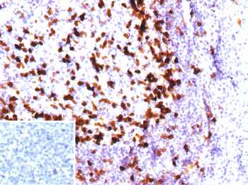 PVALB Antibody