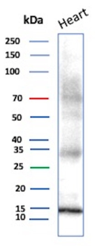 PVALB Antibody