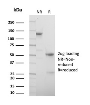 PVALB Antibody