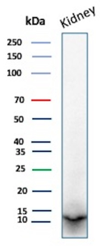 PVALB Antibody