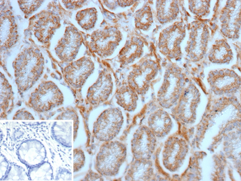 SLAMF7 Antibody
