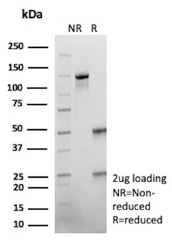SALL4 Antibody