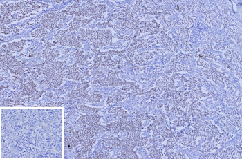 SALL4 Antibody