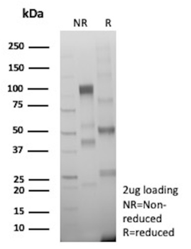 BCOR Antibody