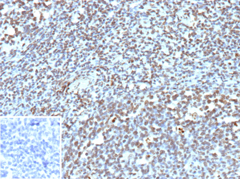 BCOR Antibody