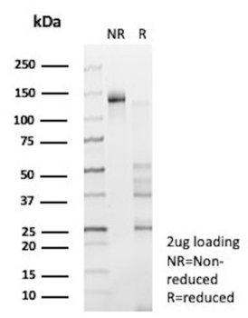 NTRK3 Antibody