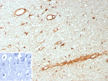 NTRK3 Antibody