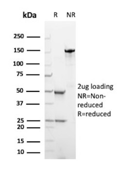 NTRK3 Antibody