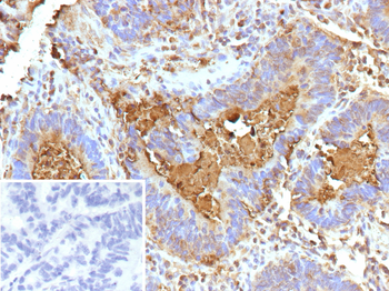 CEACAM6 Antibody