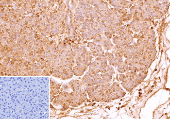 CD99 Antibody