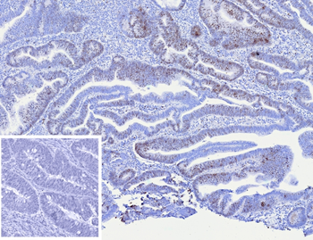 MCM4 Antibody
