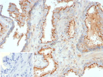 LGALS9 Antibody