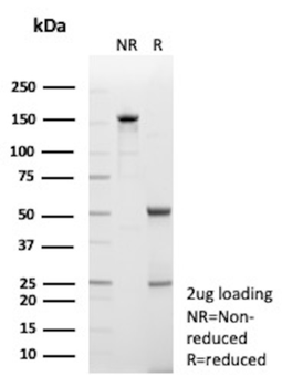 LGALS9 Antibody