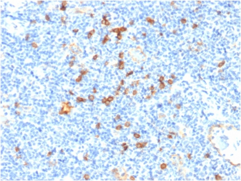 IL3RA Antibody