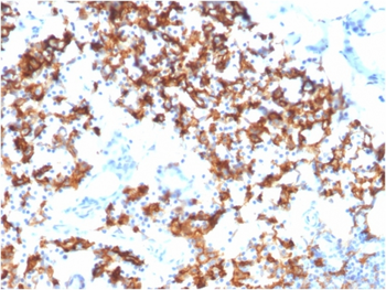IL3RA Antibody