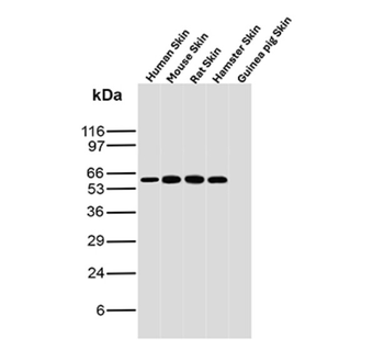 IL3RA Antibody