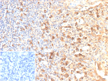 IL2RA Antibody