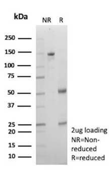 IGHG1 Antibody