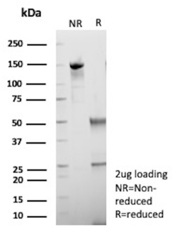 HSD17B13 Antibody