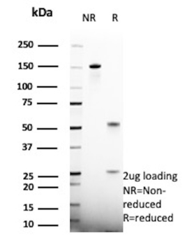 HSD17B13 Antibody
