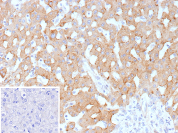 HSD17B13 Antibody