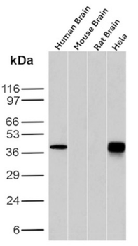 FOLR1 Antibody
