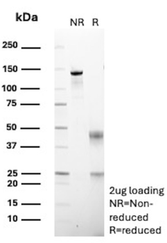 RHOBTB2 Antibody