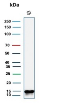 FABP2 Antibody