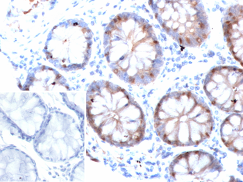 FABP2 Antibody