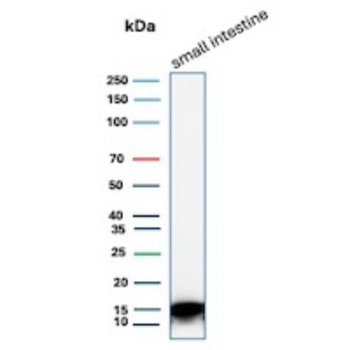 FABP2 Antibody