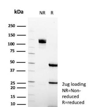 FABP2 Antibody