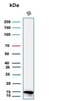 FABP2 Antibody