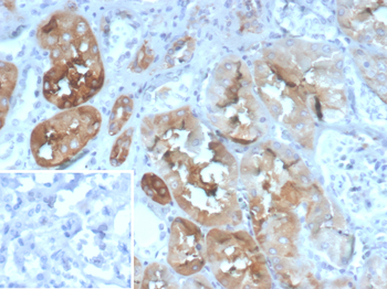 FABP2 Antibody