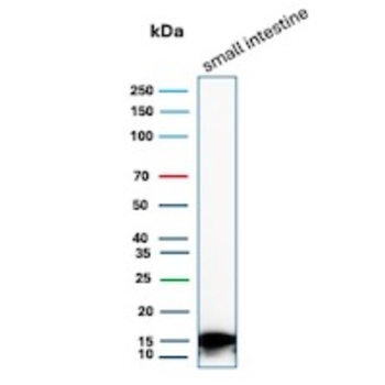 FABP2 Antibody