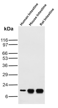 FABP2 Antibody