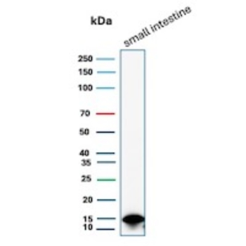 FABP2 Antibody