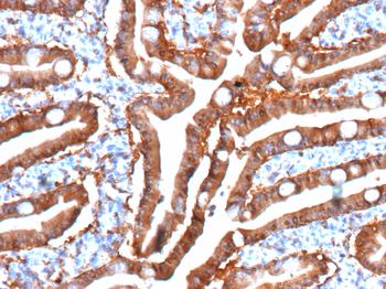 FABP2 Antibody