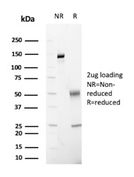 FABP2 Antibody