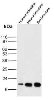 FABP2 Antibody