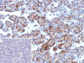 ALCAM Antibody