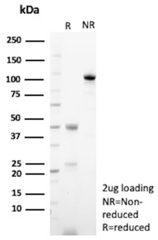 ALCAM Antibody