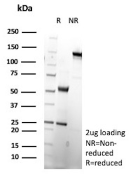 CD200R1 Antibody