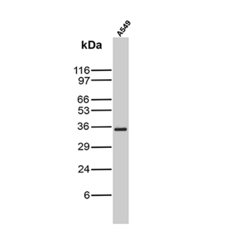 CD200R1 Antibody